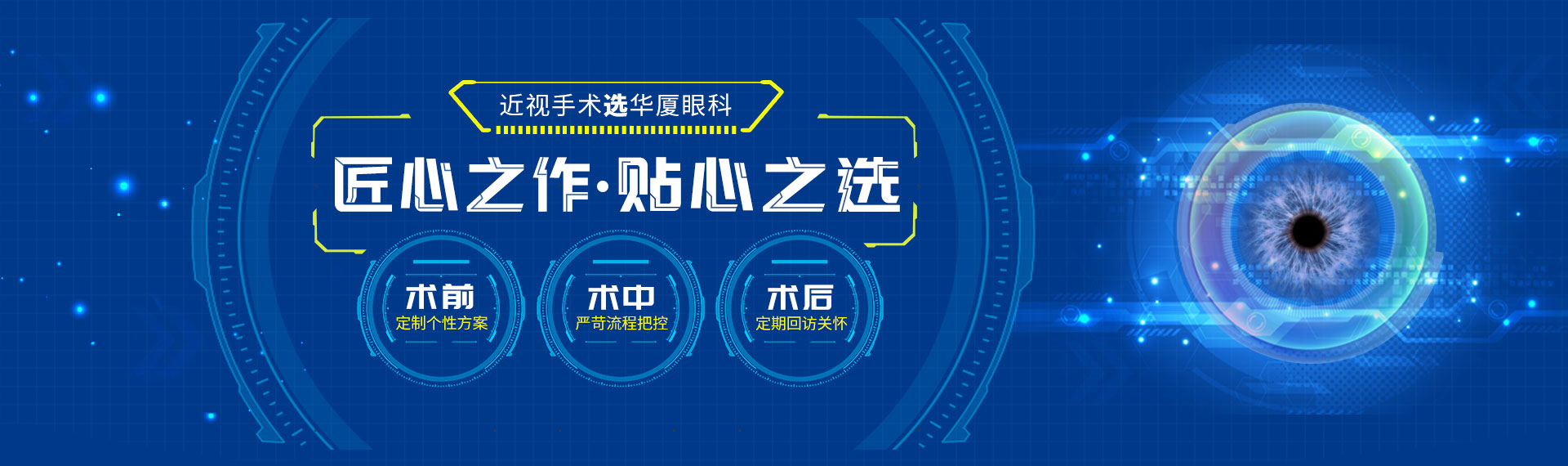 近视手术选开云手机平台-开云（中国）
